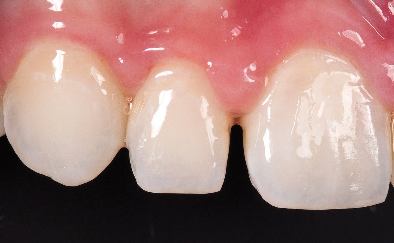 close up of teeth