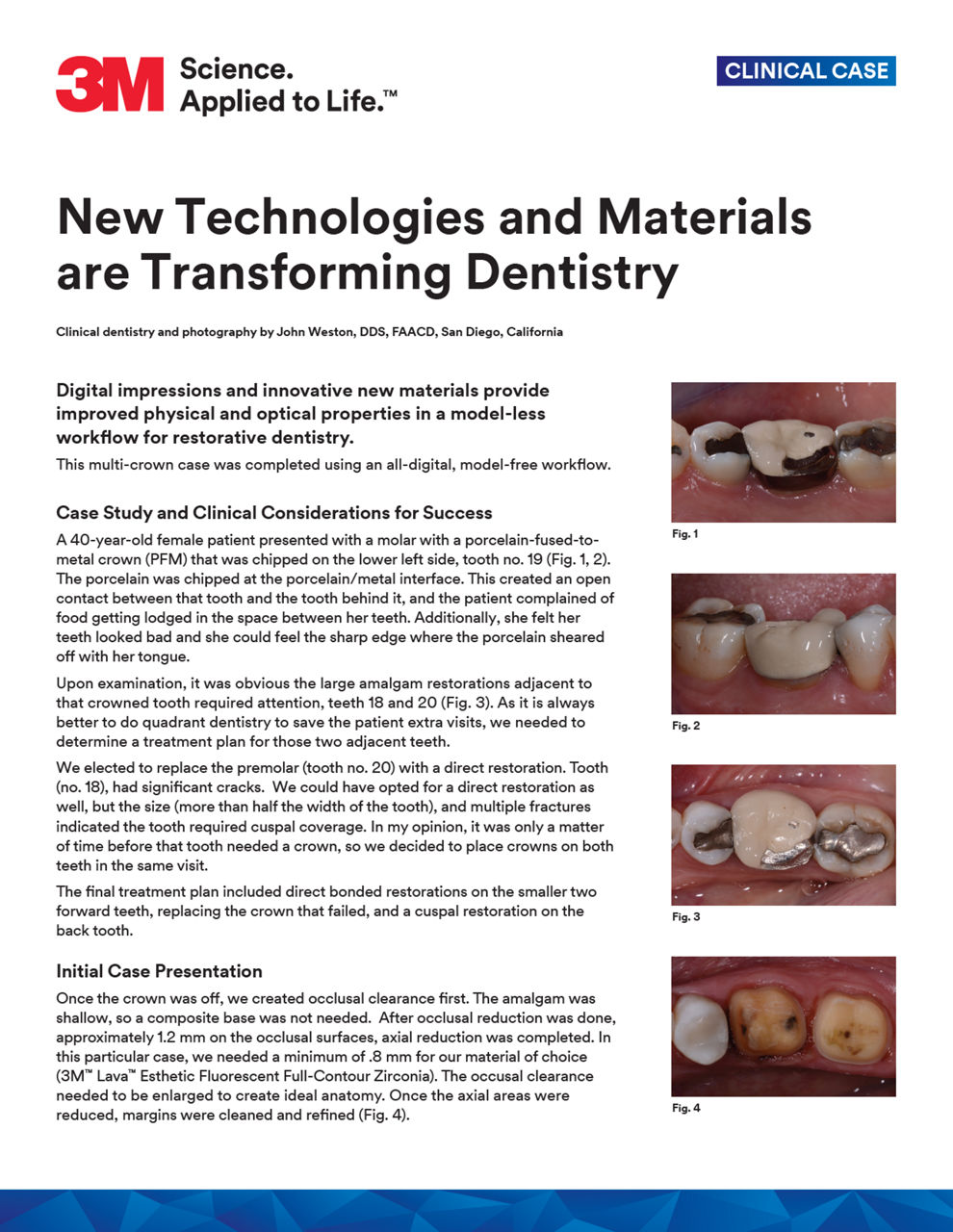 New Technologies and Materials are Transforming Dentistry