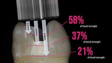 Informative oral care related imagery with a file name of CuringLIght_Story10.jpg shown on Solventum's "Brain Floss" blog