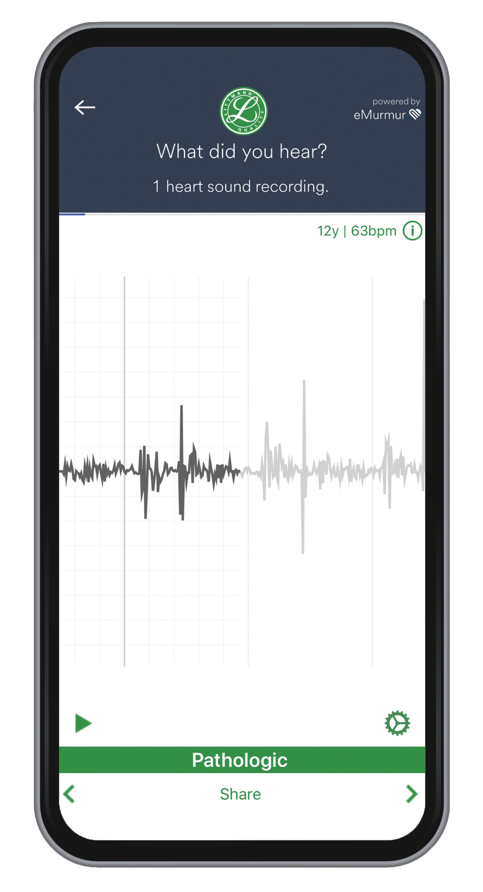 Littmann University App task screen audio mockup on mobile phone device, powered by eMurmur