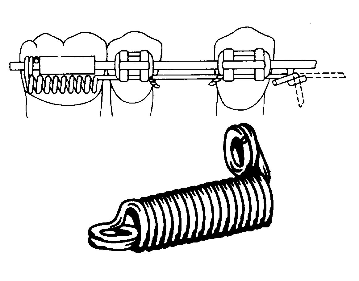 343-430 Unitek™ Pletcher T Spring Looped .009/030 10/Pk