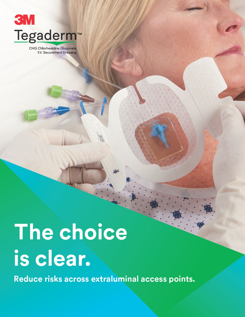 Tegaderm™ CHG Dressing Family Brochure - Digital HR