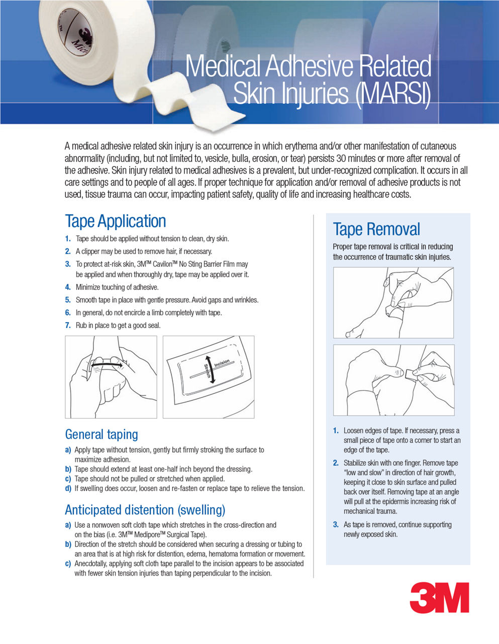 Medical Adhesive Related Skin Injuries (MARSI)