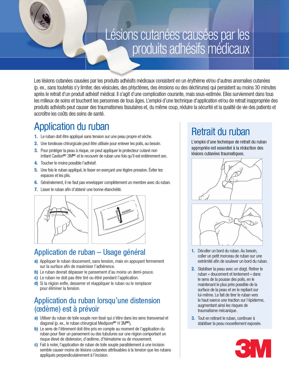 Lésions cutanées causées par les  produits adhésifs médicaux