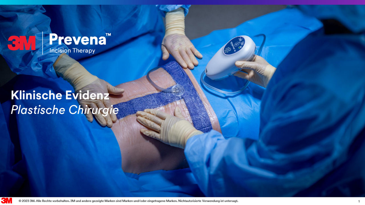 Klinische Erkenntnisse zur Prevena-Therapie nach plastischer Chirurgie - Vorschau