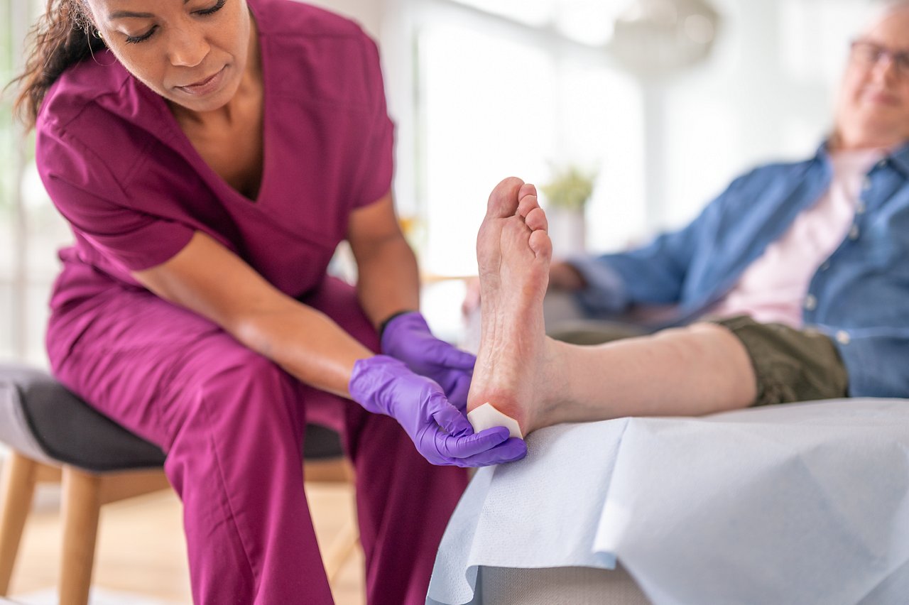 Clinician applying 3M™ Promogran Prisma™ Matrix on the patient's heel, TIF file.