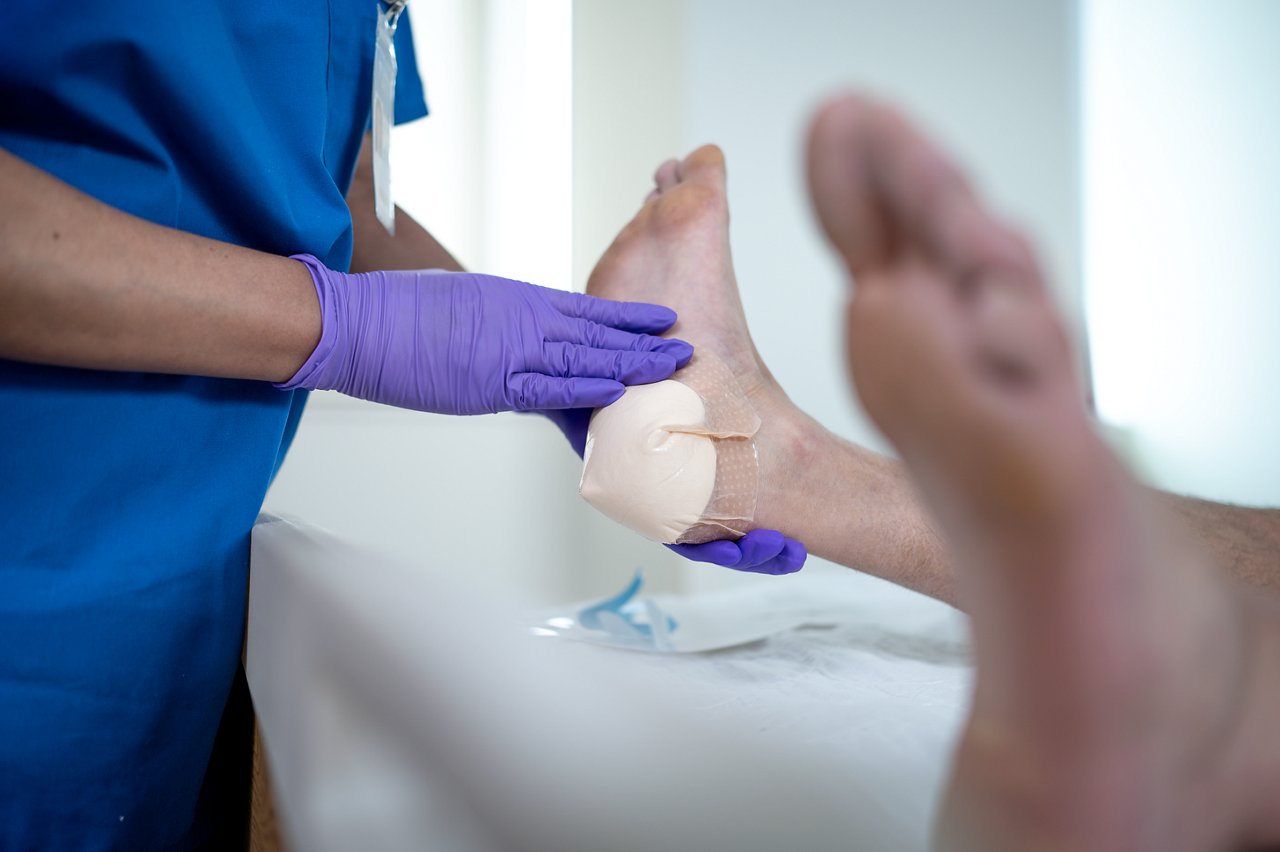 Kliniker beim Auftragen von 3M™ Tegaderm™ Silikonschaumverband auf eine Verletzung des Drucks auf der Ferse. Bild 2