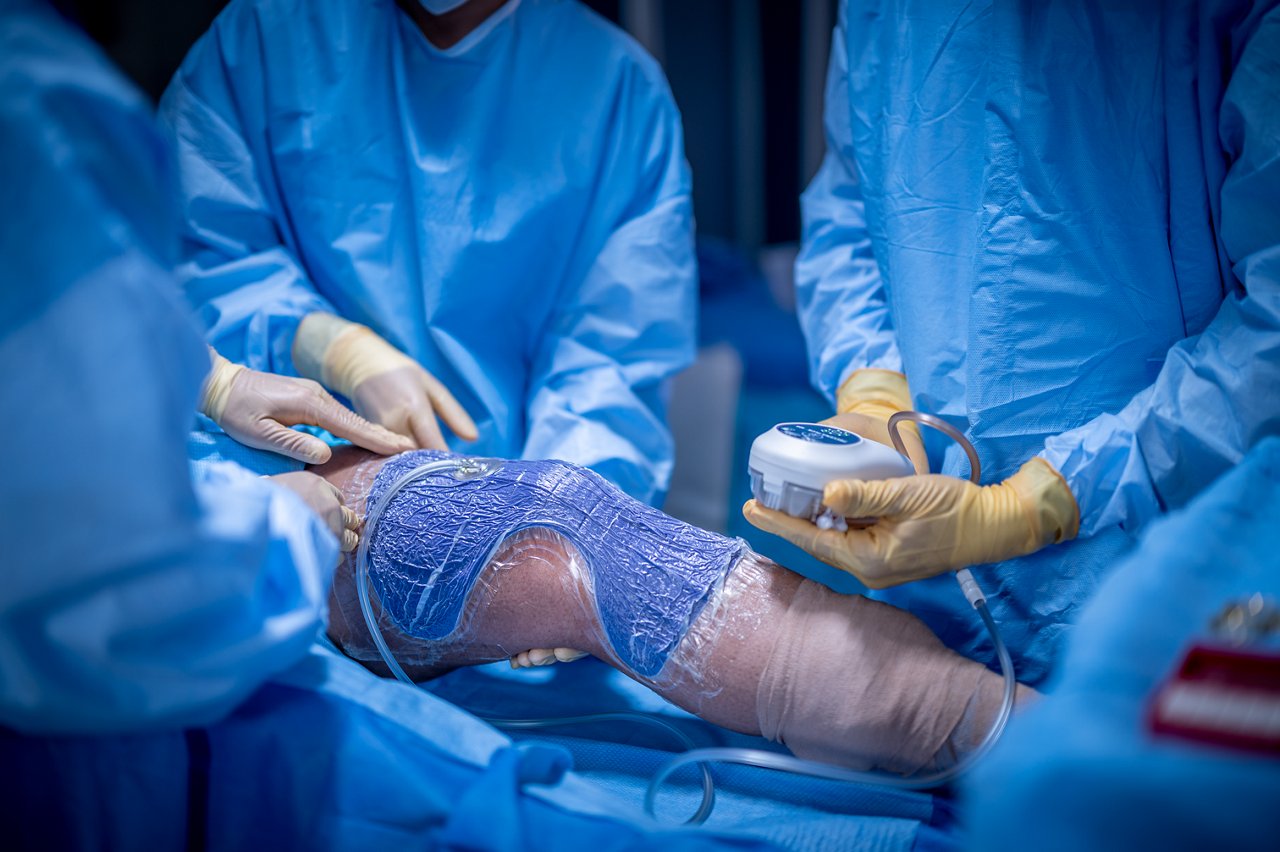 Knee incision with 3M™ Prevena Restor™ Arthro Form™ Dressing applied. MedPeople_OR_11967