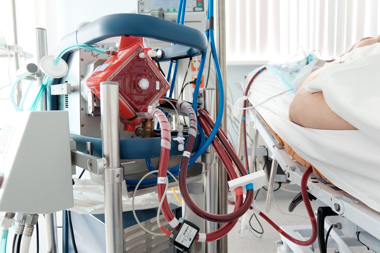 Working ECMO Machine in intensive care department