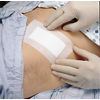 3M™ Medipore™ + Pad 3571E