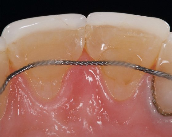 Palatal view