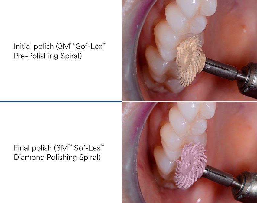 Informative oral care related imagery with a file name of Dr-Benecke.jpg shown on Solventum's "Brain Floss" blog