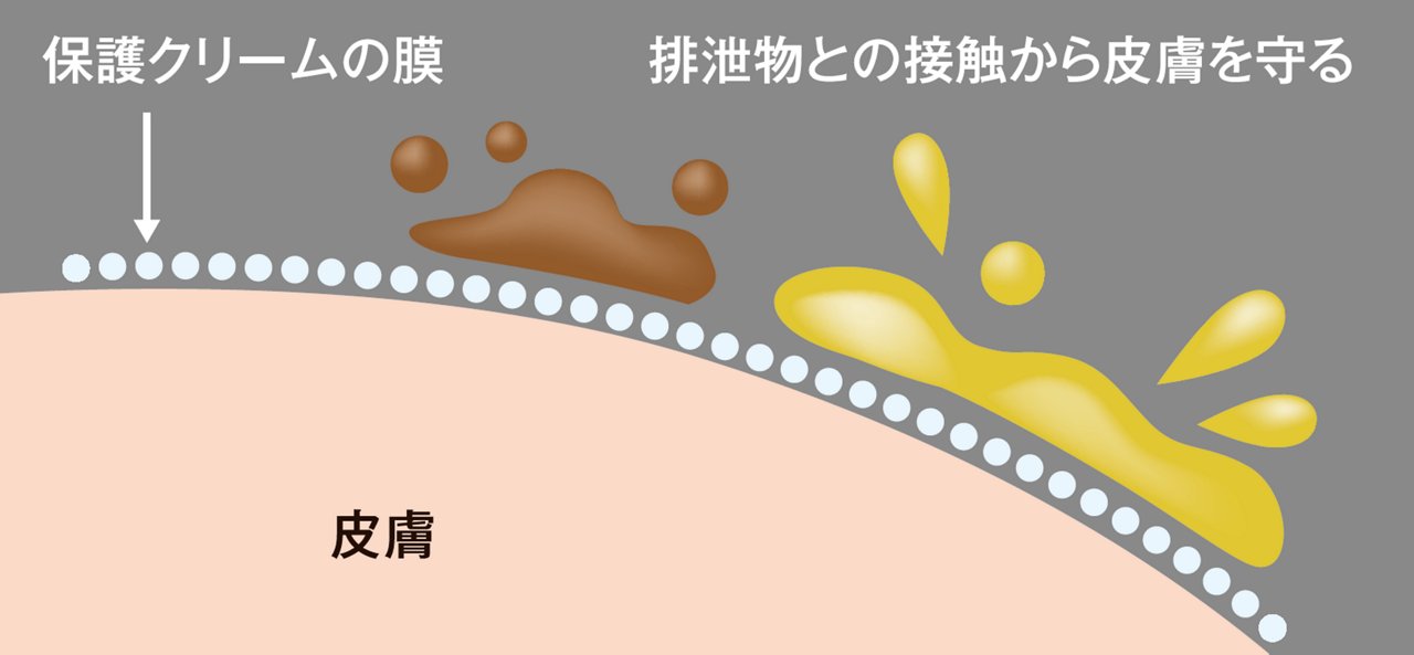 保護クリームの膜がおしっこ・うんちの接触から皮膚を守る