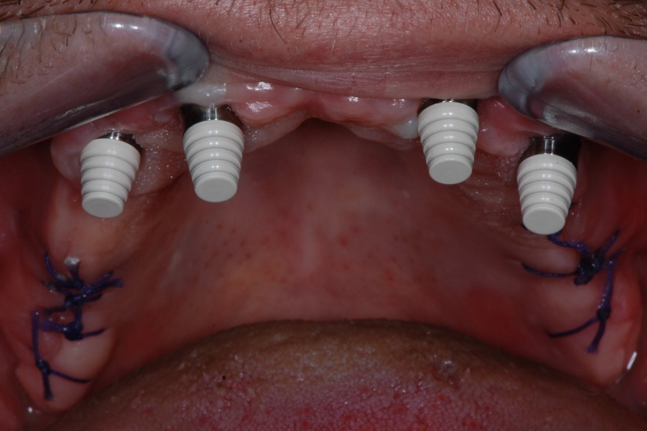 Informative oral care related imagery with a file name of 3MOCSD_IG_Round18_CC_See_GCTabletop_560x460_Blog_7.png shown on Solventum's "Brain Floss" blog