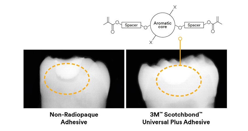 Informative oral care related imagery with a file name of Walter_DevotoFig_13_1_rz-rotated.jpg shown on Solventum's "Brain Floss" blog