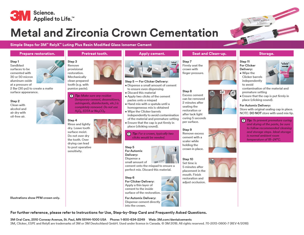 Metal and Zirconia Crown Cementation