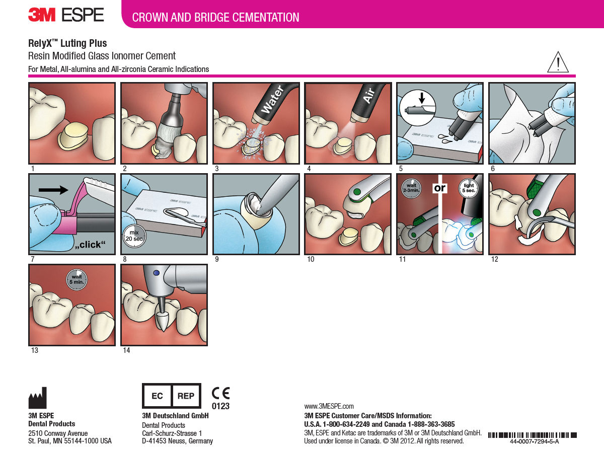 RelyX Luting PLus Clicker Technique Guide