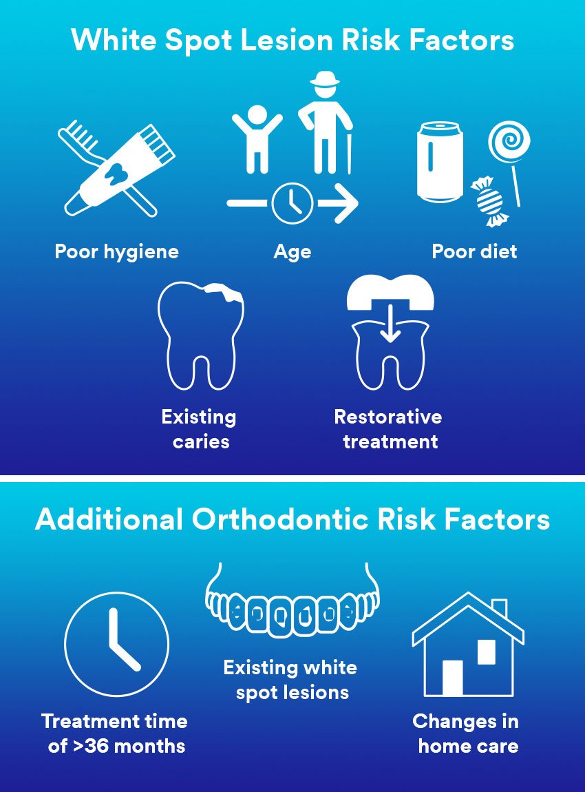 Informative oral care related imagery with a file name of Ways-to-optimize-the-teamwork-with-the-dental-technician_3.png shown on Solventum's "Brain Floss" blog