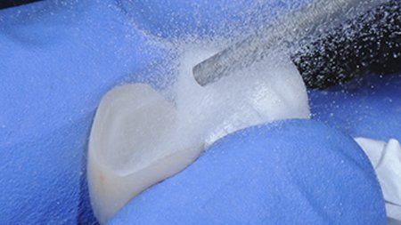 Pre-treat zirconia restorations by sandblasting