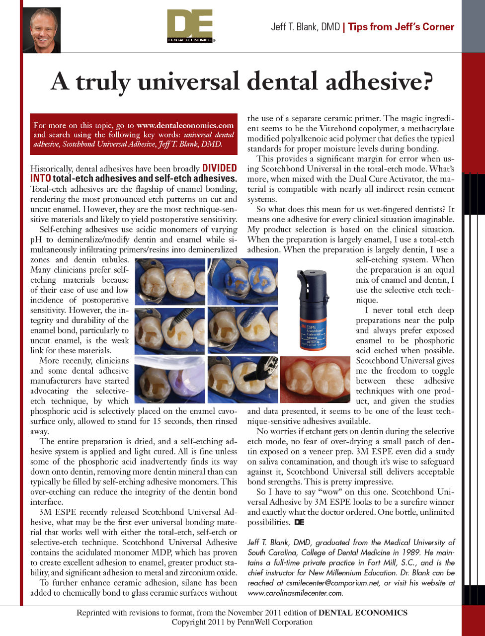 3M™ Scotchbond™ Universal Adhesive A Truly Universal Adhesive?