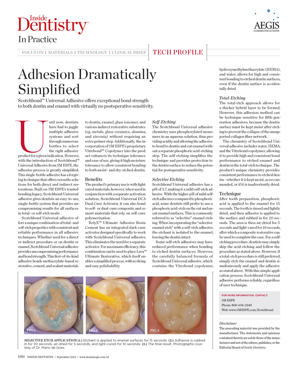Inside Dentistry - Adhesion Dramatically Simplified Eprint