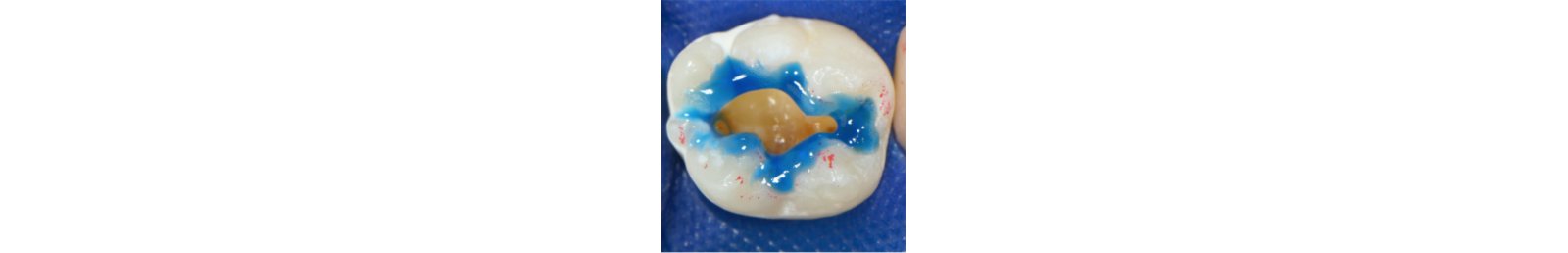 Informative oral care related imagery with a file name of 3MOCSD_IG_Round19_CC_Thering_FunctionalEsthetic_560x460_Blog_8.png shown on Solventum's "Brain Floss" blog
