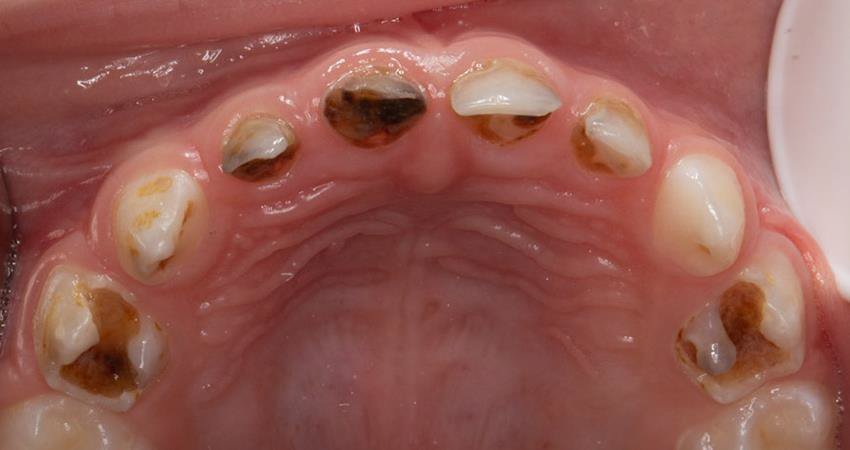 Informative oral care related imagery with a file name of Esthetic-Restoration-560.jpg shown on Solventum's "Brain Floss" blog