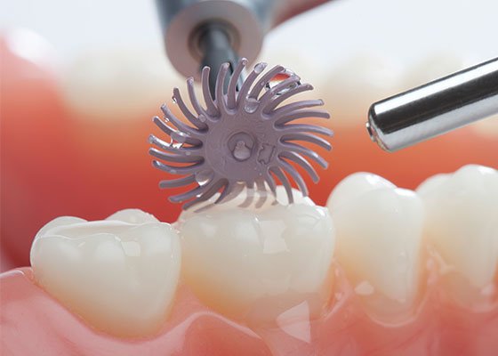 Informative oral care related imagery with a file name of 4_Stick-to-innovation-Five-benefits-of-modern-universal-adhesives.png shown on Solventum's "Brain Floss" blog