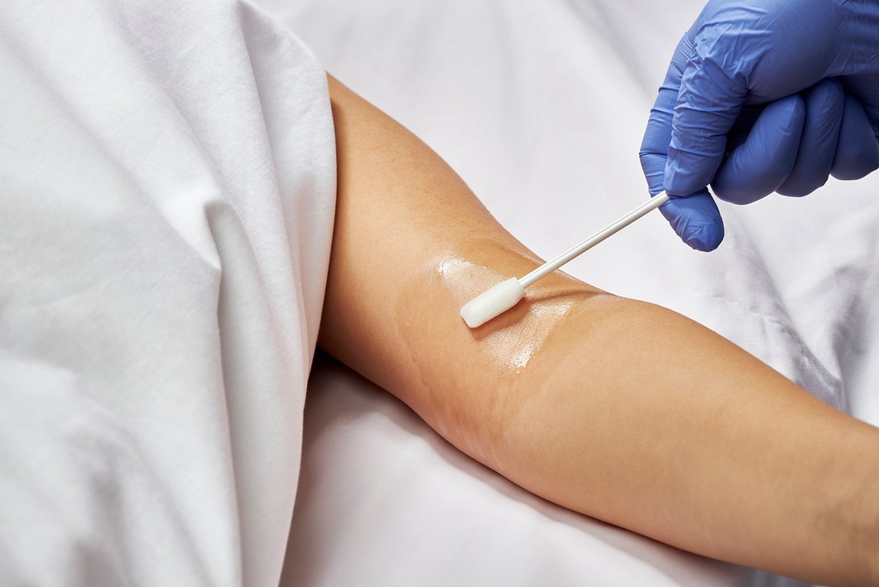 3M SoluPrep Small Swab 102.03 (clear) being applied to the upper arm