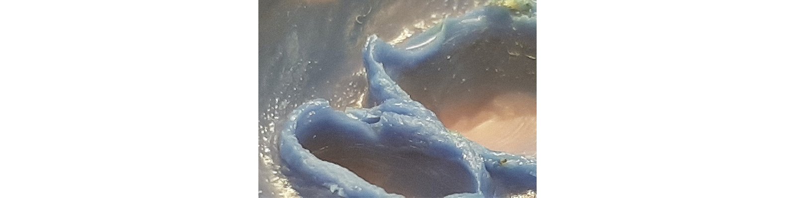 Informative oral care related imagery with a file name of Patricia_Gaton_Fig2_rz.jpg shown on Solventum's "Brain Floss" blog