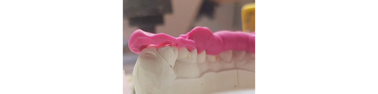 Informative oral care related imagery with a file name of Patricia_Gaton_Fig3_rz.jpg shown on Solventum's "Brain Floss" blog
