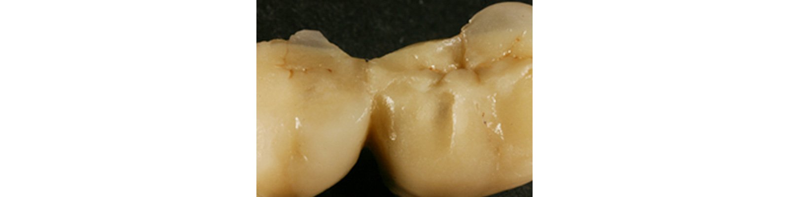 Informative oral care related imagery with a file name of Patricia_Gaton_Fig4_rz.jpg shown on Solventum's "Brain Floss" blog
