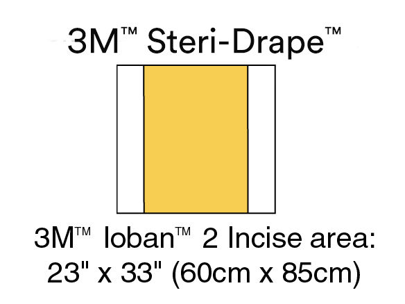 3M Steri Drape 6651EU