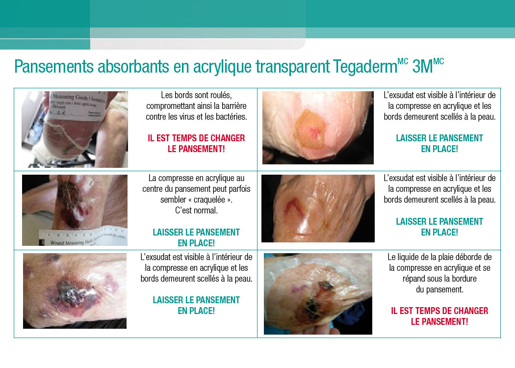 Tegaderm Acryilc Dressing Change Postcard- FR (1204-01023F).pdf