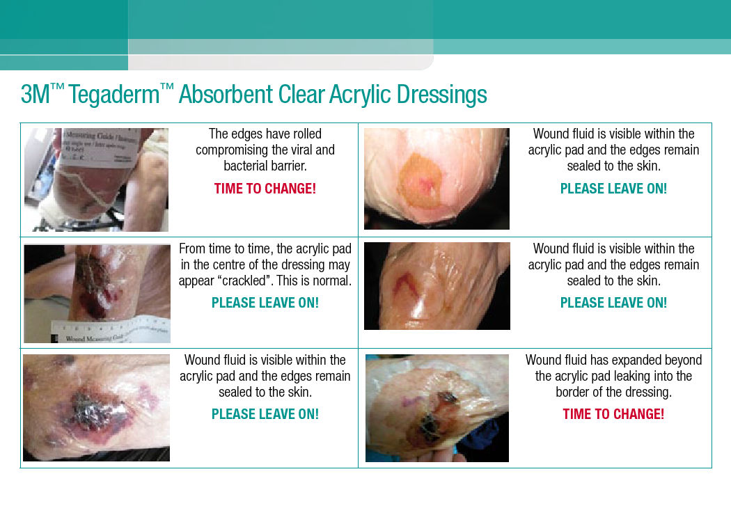 Tegaderm Acrylic Dressing Change Postcard (1204-01023E).pdf