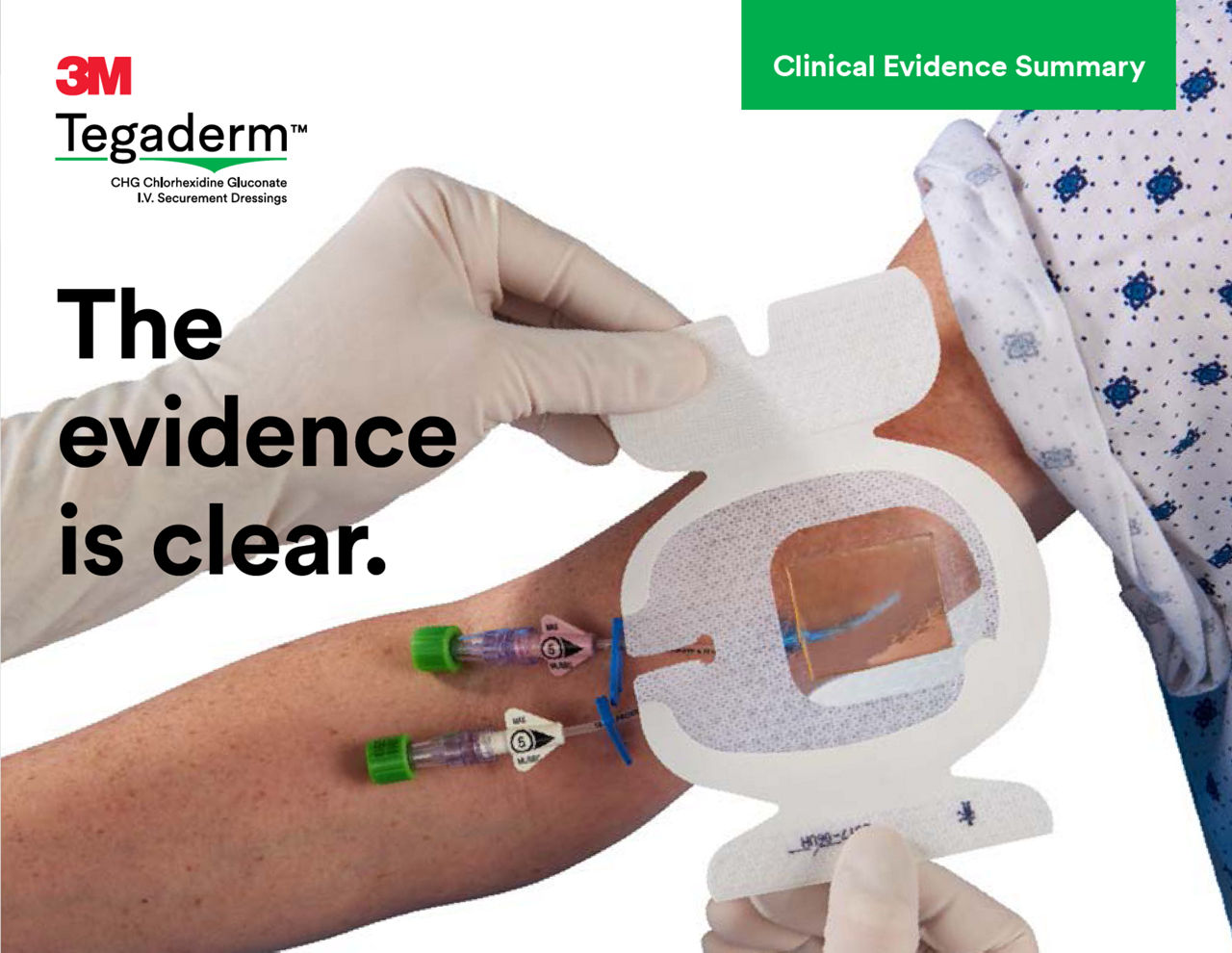 Tegaderm CHG studies preview