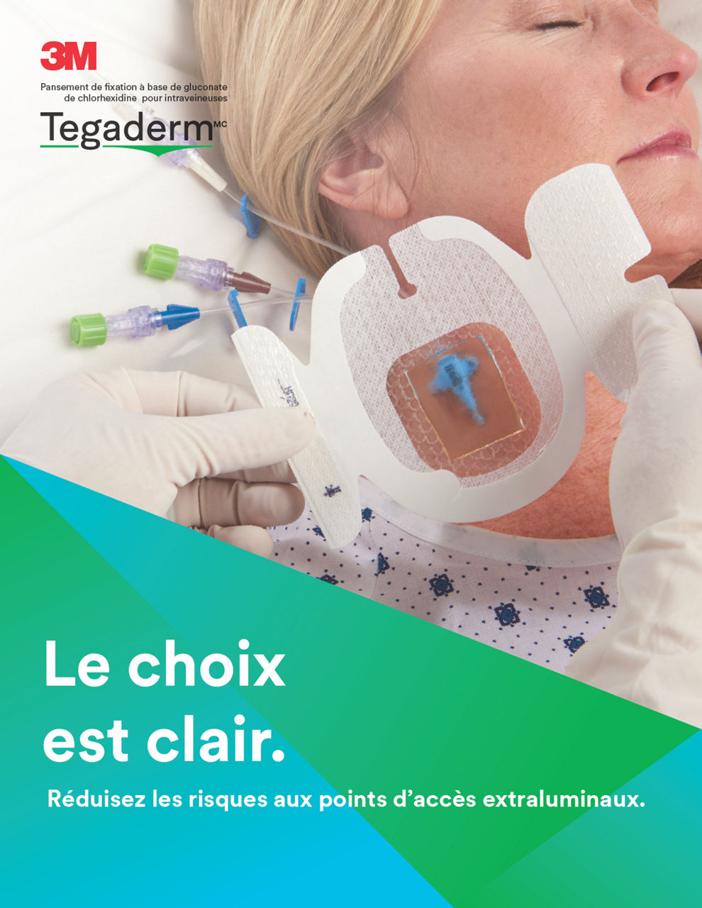 Aperçu de la gamme de pansements Tegaderm CHG