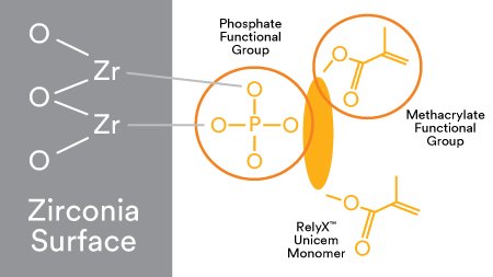 Informative oral care related imagery with a file name of Patricia-Gaton-Fig.-6_rz.jpg shown on Solventum's "Brain Floss" blog