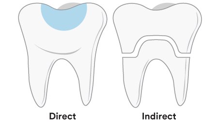 Informative oral care related imagery with a file name of Universal-Adhesive-Tooth-Side-by-Side-450x253-1.png