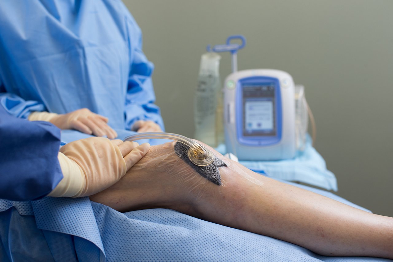 患者が病院で看護スタッフと共にVAC療法を準備し適用する様子; 写真8