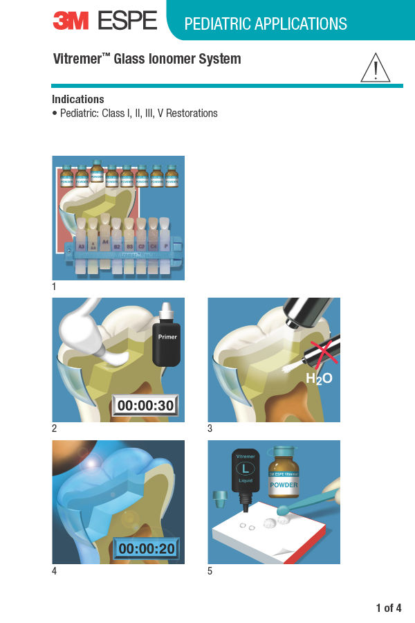 3M™ Vitremer™ Glass Ionomer System Pediatric - Application Guide