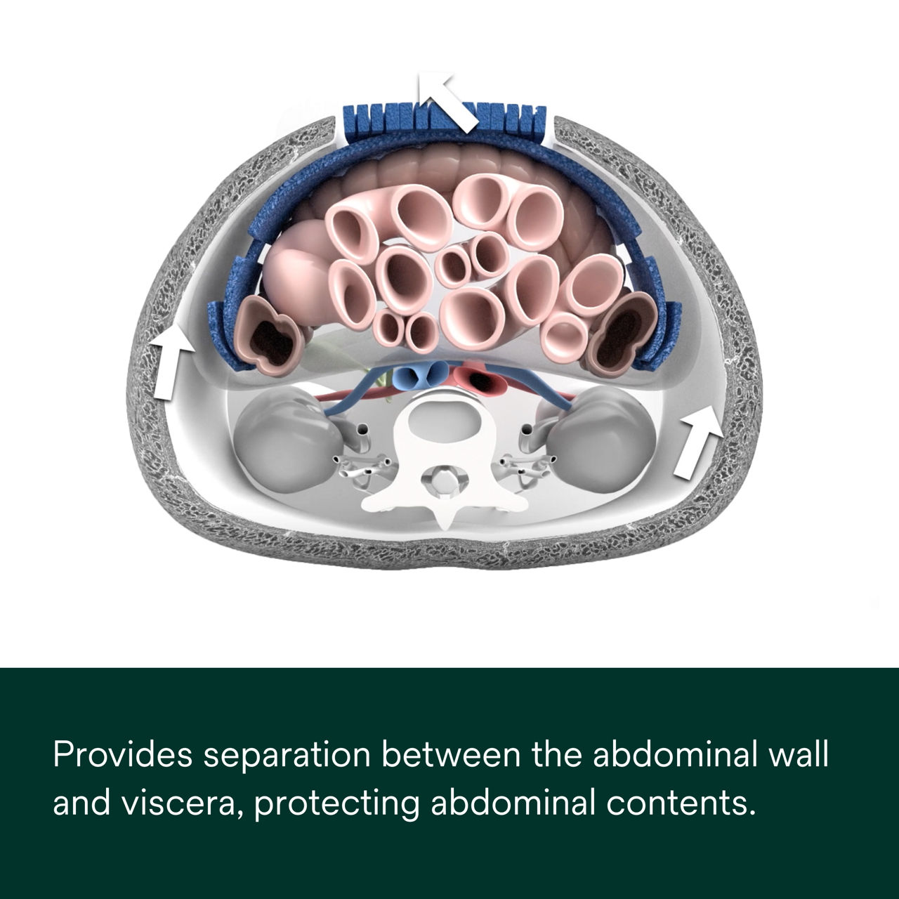 AbThera Advance Open Abdomen Dressing PDP Secondary Image 5