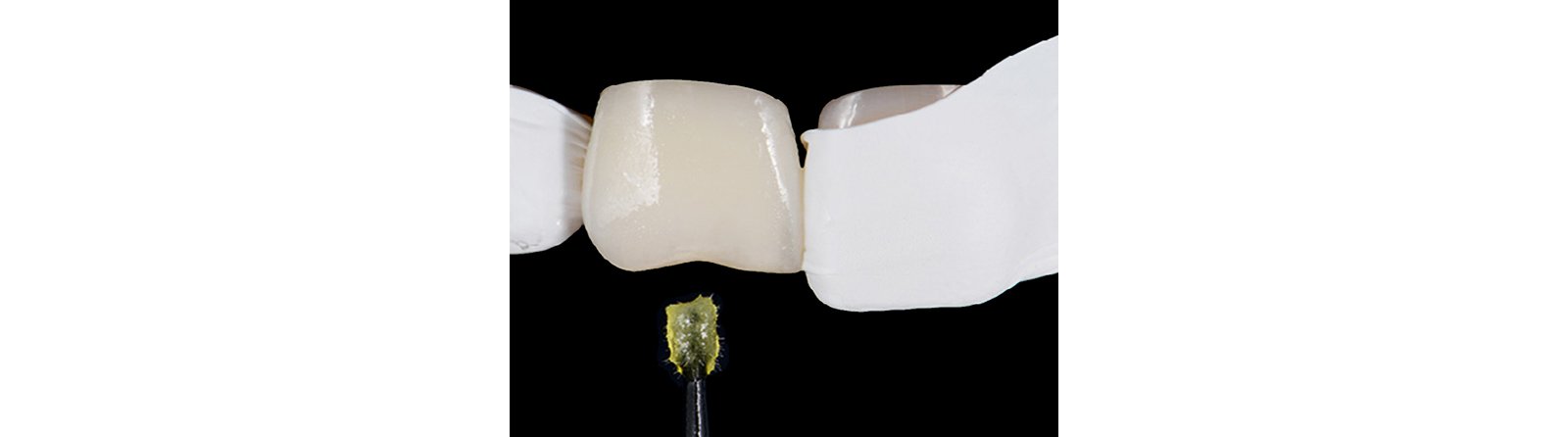 Application of adhesive