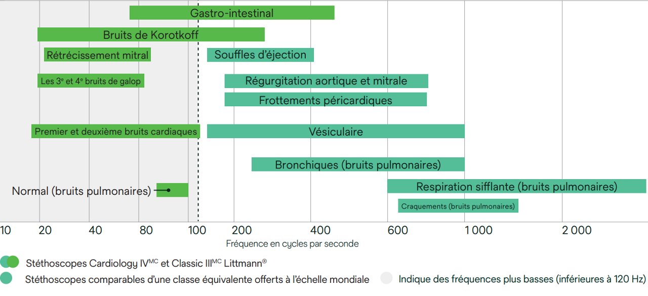 Image d’un graphique montrant les différences dans les fréquences sonores que les stéthoscopes peuvent détecter