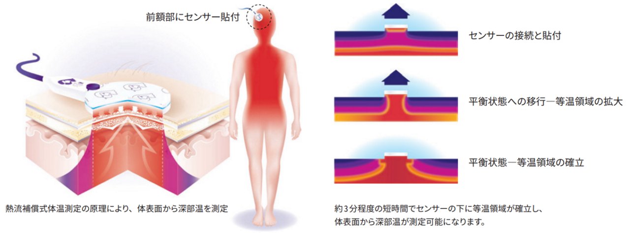 3M™ ベアーハガー™ 深部温モニタリングシステムは皮膚表面に貼付したセンサーを緩やかに加温し、センサーの下に深部温との等温領域を作り出します。