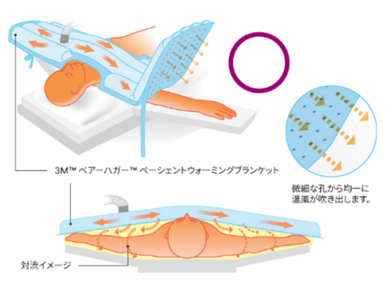 対流による加温は接触面以外の部分も均一に加温することができます。