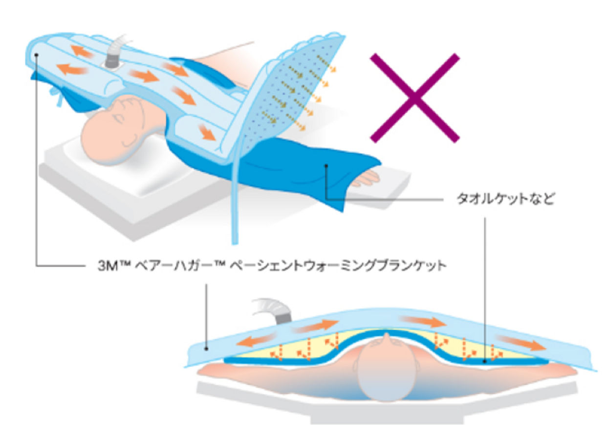 タオルケットなどを挟むと、加温のための対流が妨げられてしまいます。