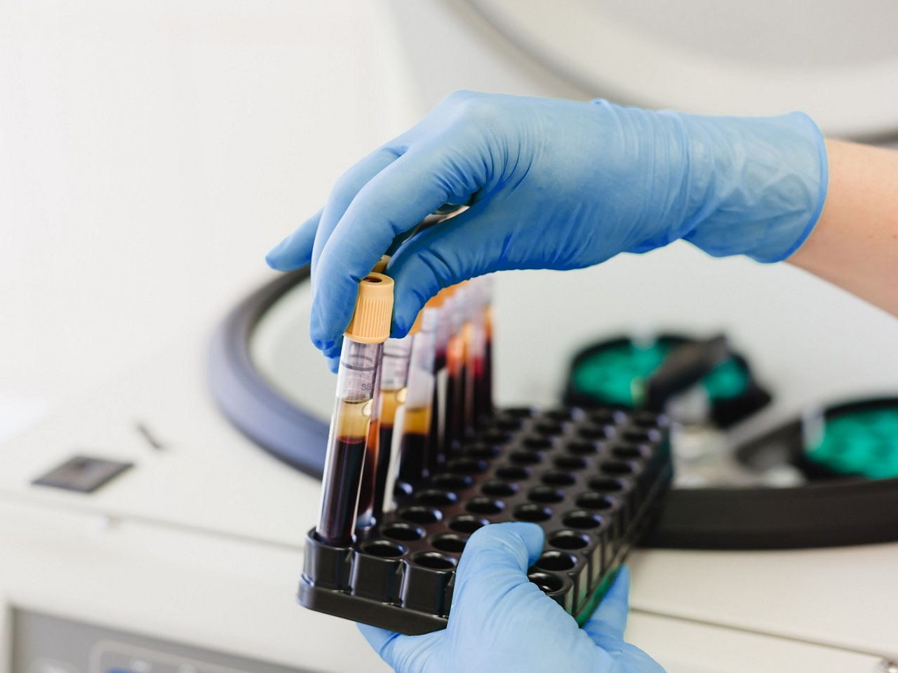 Hands in blue medical gloves hold a tripod with test tubes containing blood samples. The blood has been divided into fractions. Blood plasma. In the background, there is a centrifuge.
