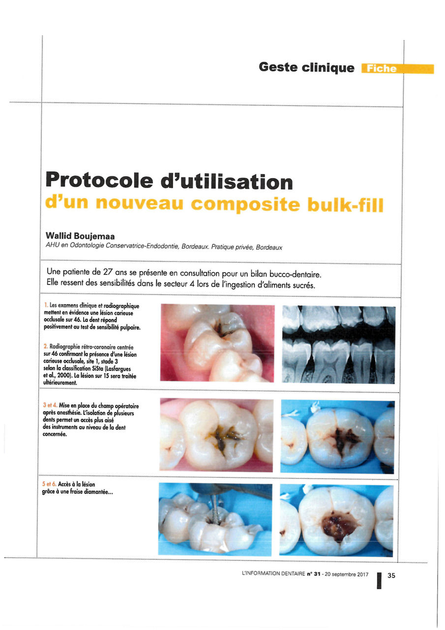 Cas Clinique 3M™ Filtek™ One molaire