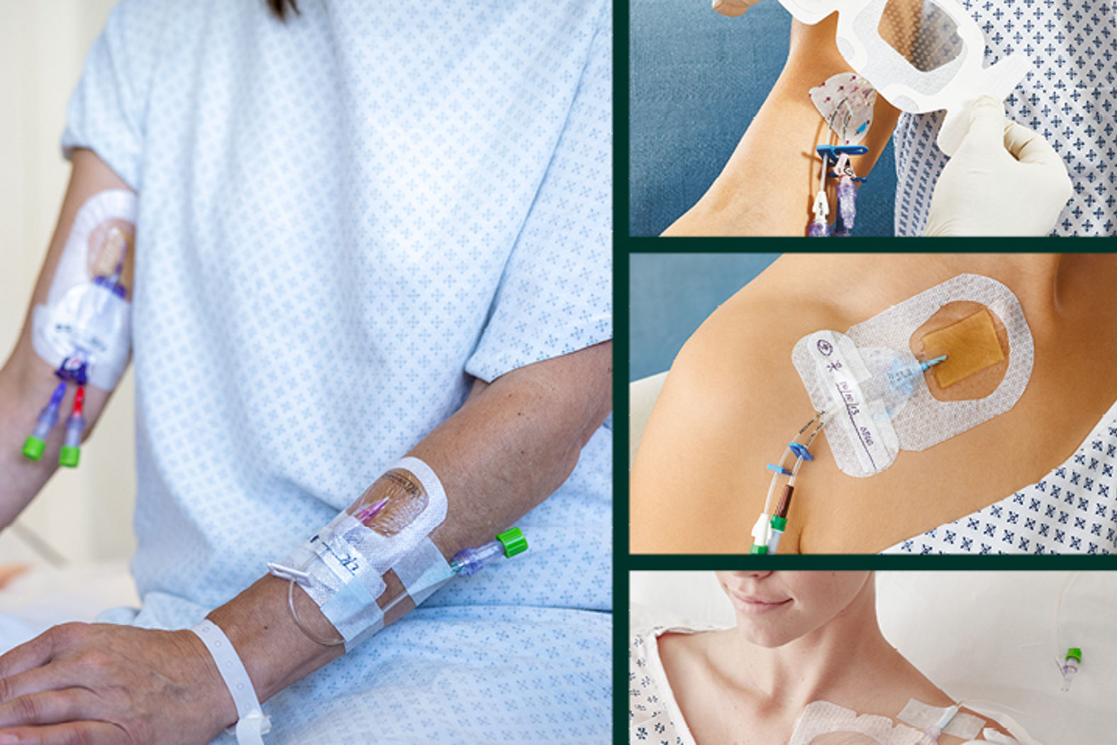 I.V.-Verbände | Solventum, image size:1575x1050